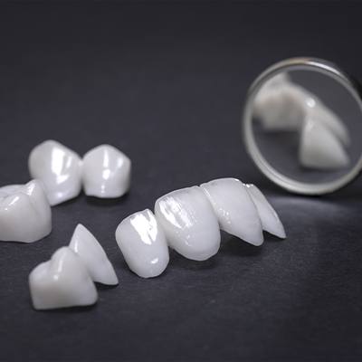 different types of restorations