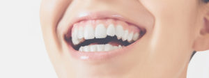 woman smiling healthy pink gums